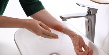 Woman,Putting,Burned,Hand,Under,Running,Cold,Water,Indoors,,Closeup
