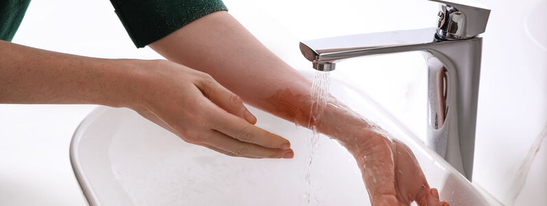 Woman,Putting,Burned,Hand,Under,Running,Cold,Water,Indoors,,Closeup